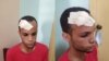 Raúl Soublet se auto agredió durante un violento interrogatorio de la Seguridad del Estado.