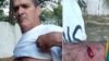 Opositor agredido cuando se dirigía a votar