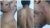 Luis Manuel Otero Alcántara muestra los golpes recibidos durante la detención en una unidad de policía. Tomado de su perfil de Facebook