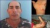 El periodista independiente Osvaldo Landín Baños fue atropellado por la policía durante su arresto. (Foto: ICLEP)
